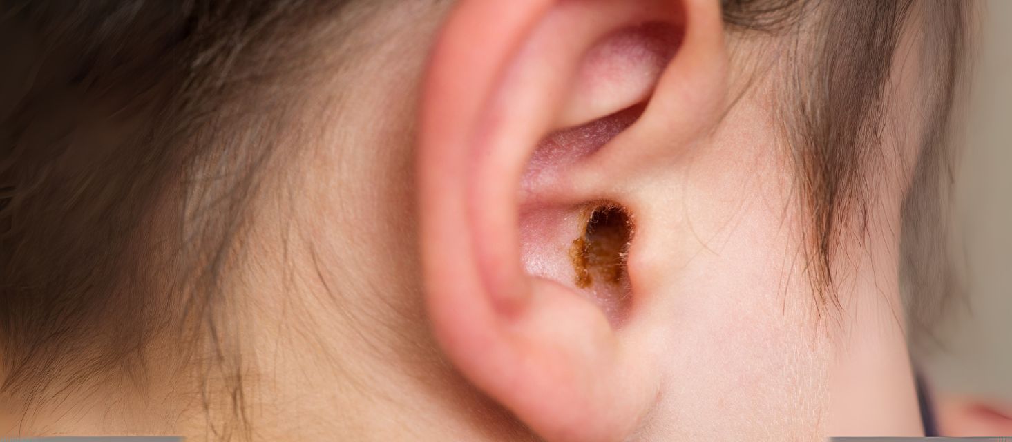 What Is Earwax