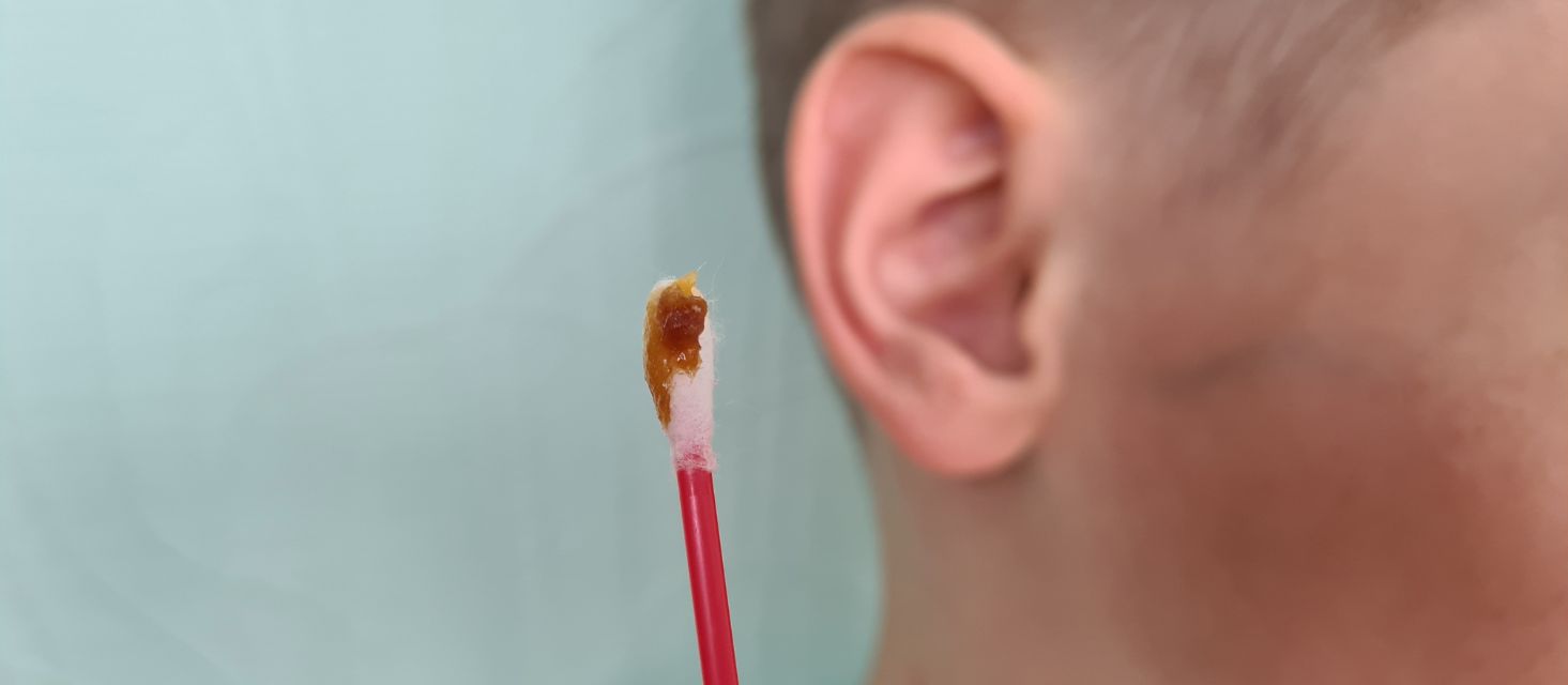 where do ear wax come from